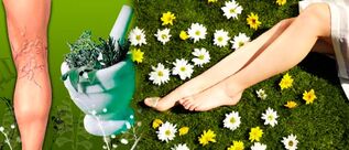 Folk remedies to fight varicose veins of the legs
